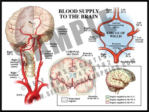 Medical Illustration of Blood Supply to The Brain