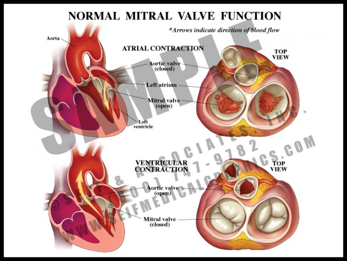 Medical Illustration of Normal Mitral Valve Function