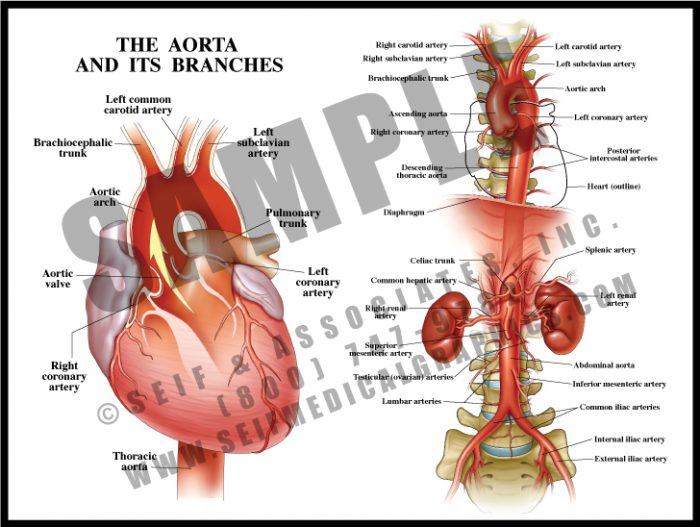 Medical Illustration of The Aorta and Its Branches