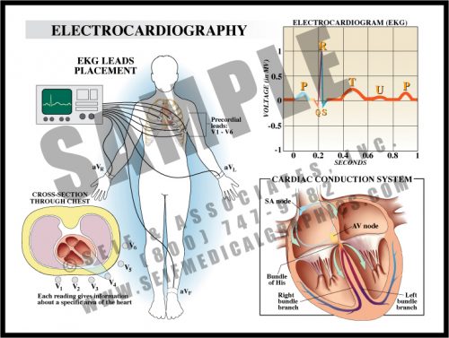 Medical Illustration of Electrocardiography
