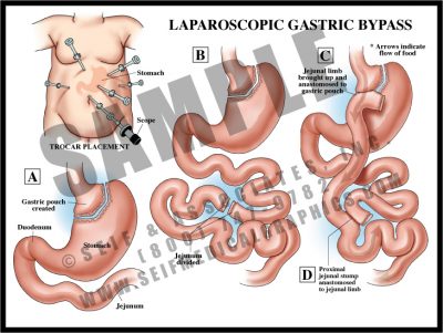 Upper Abdominal Anatomy - S&A Medical Graphics