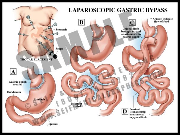 Upper Abdominal Anatomy - S&A Medical Graphics