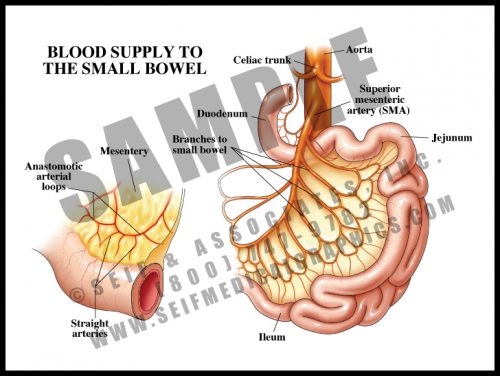 Medical Illustration of Blood Supply to The Small Bowel