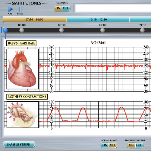 Fetal Heart Monitor Interactive