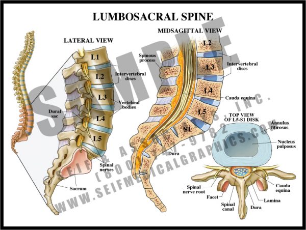 Lumbosacral Spine - S&A Medical Graphics