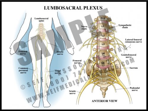 Medical Illustration of Lumbosacral Plexus
