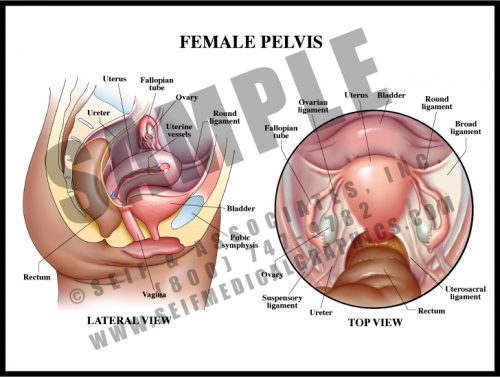 Medical Illustration of Female Pelvis