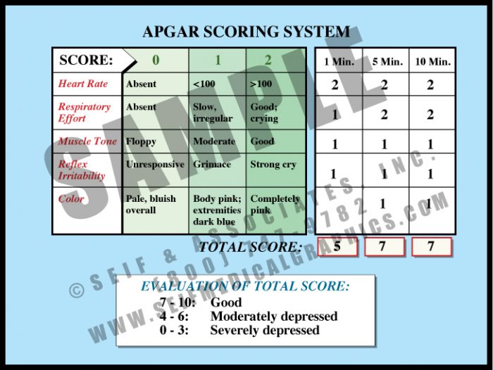 Medical Illustration of APGAR Scoring System