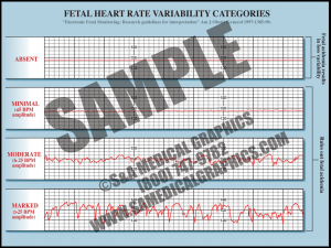 EFM (Normal Strip) - S&A Medical Graphics