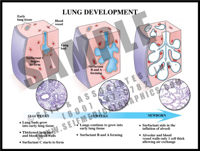Medical Illustration of Lung Development