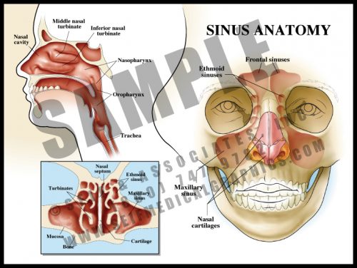 Medical Illustration of Sinus Anatomy