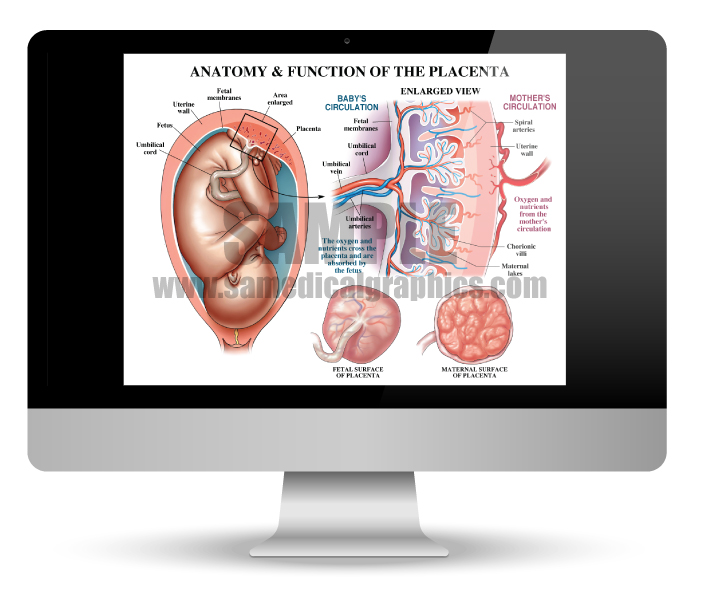 Medically Illustrated Webinars