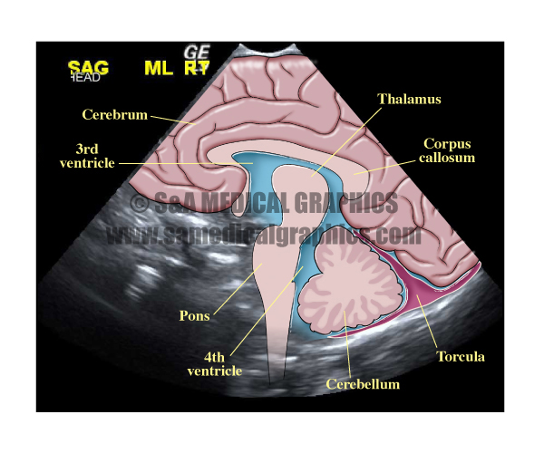 Illustrated Radiology Image Overlay of Brain From Ultrasound