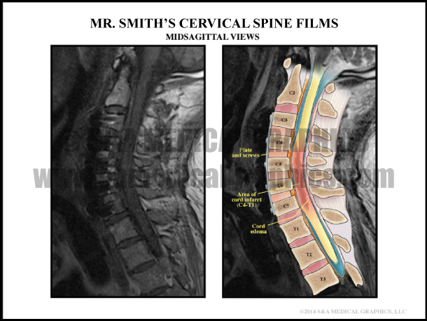 Cervical Spine Film