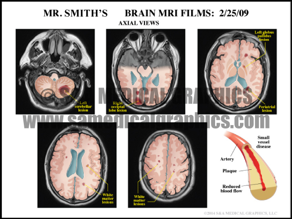 Brain MRI Medical Illustration