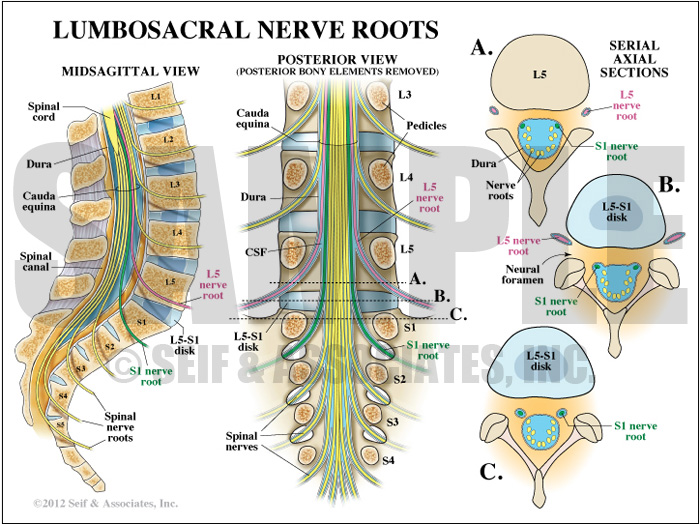 Lumbosacral Nerve Roots Medical Illustration