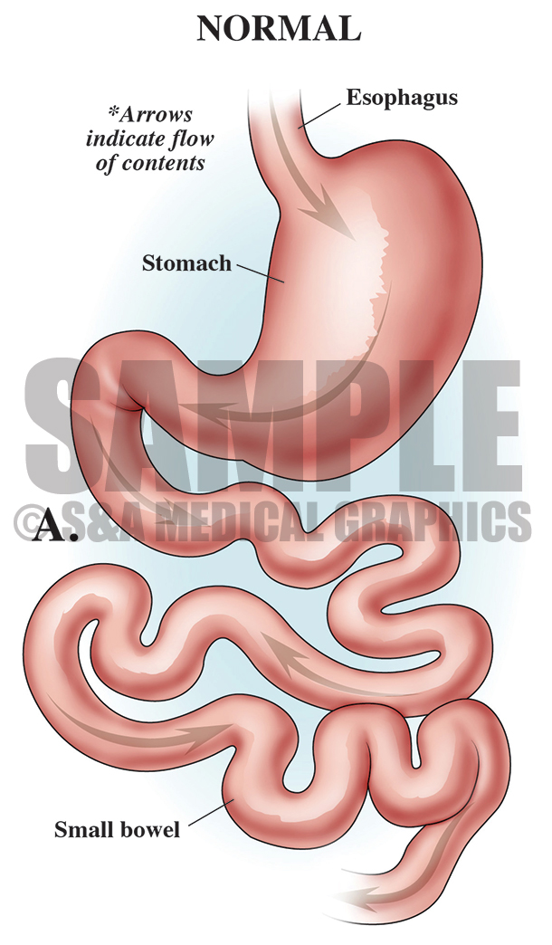 Normal Stomach Medical Illustration