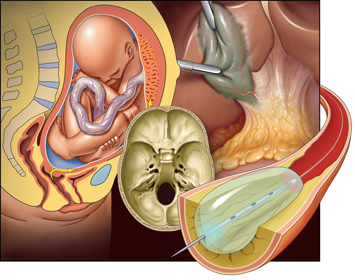 S&A Medical Graphics | Medical Legal Illustration |