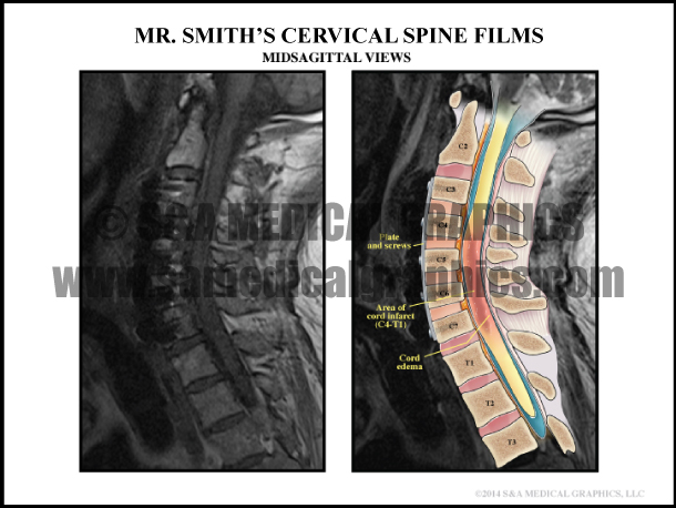 Cervical Spine Film Medical Illustration