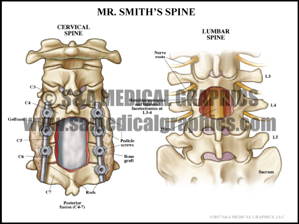 Cervical and Lumbar Spine Medical Illustration